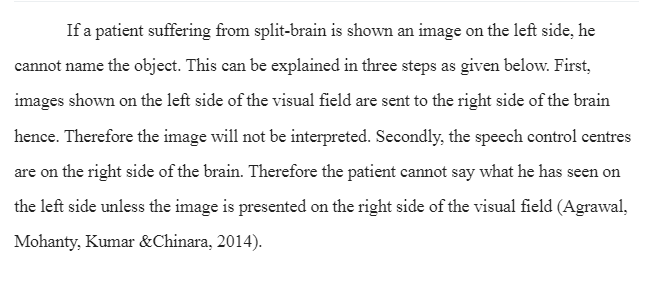 Split-Brain Syndrome